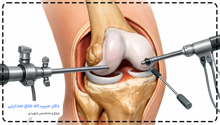 آرتروسکوپی زانو چیست