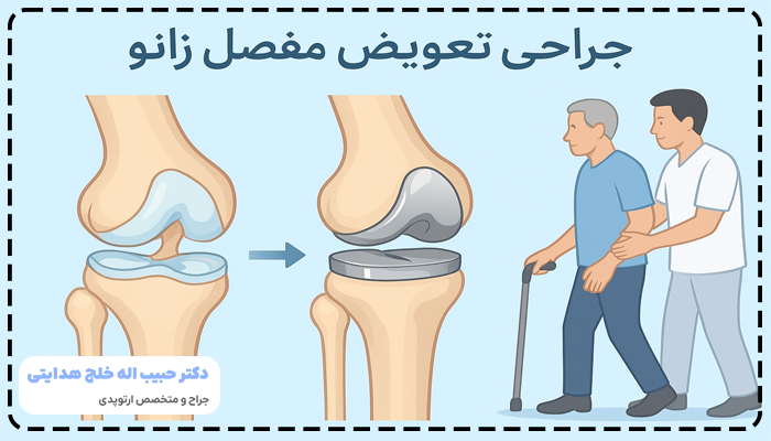 راه رفتن بعد از عمل تعویض مفصل زانو