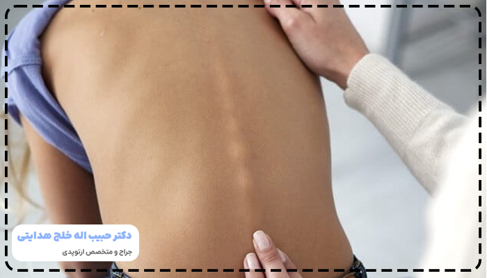 نحوه تشخیص انحراف ستون فقرات