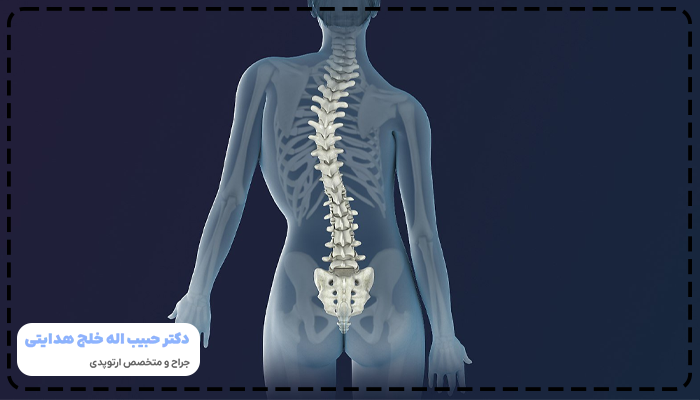 اسکولیوز Scoliosis