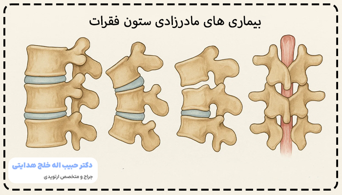 بیماری های مادرزادی ستون فقرات