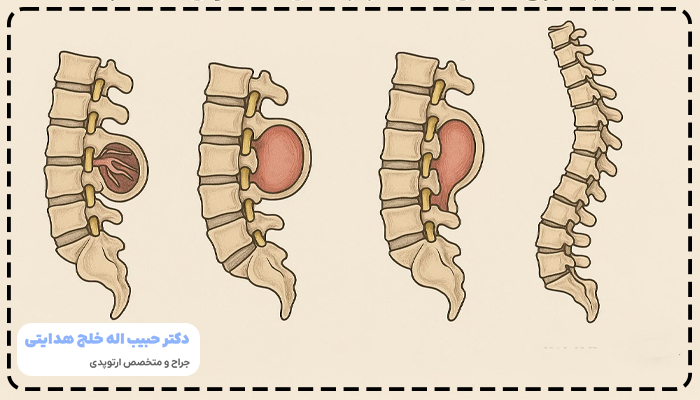 ناهنجاری های مادرزادی نخاعی