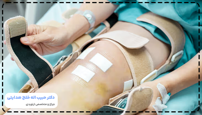 مدت زمان بهبودی کامل بعد از عمل تعویض مفصل زانو